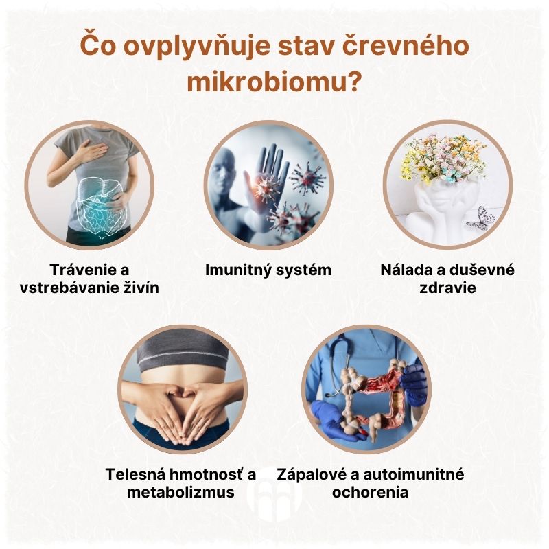 (Slovenčina) Co stav střevního mikrobiomu ovlivňuje